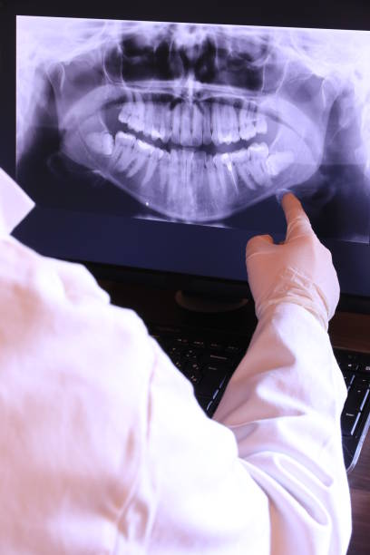 Best Emergency Tooth Extraction in Riverside, IL