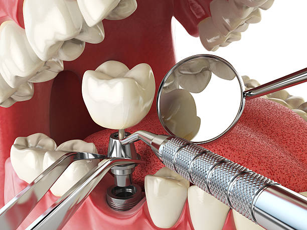 Best Emergency TMJ Treatment in Riverside, IL