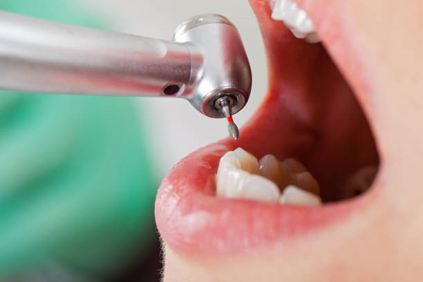 Best Emergency Gum Treatment in Riverside, IL